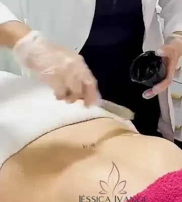 Massagem modeladora no abdômen, feita com as mãos de luva